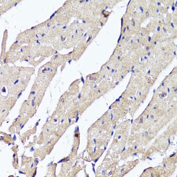 ACSS2 Antibody