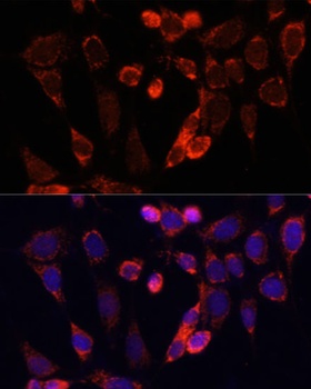 ACSS2 Antibody