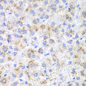 HAO1 Antibody