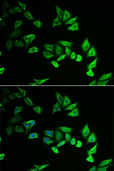 MYOZ2 Antibody