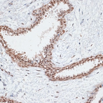 AHSP Antibody