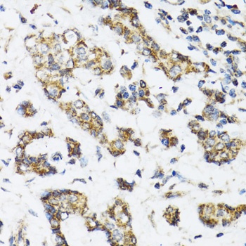 DHRS2 Antibody