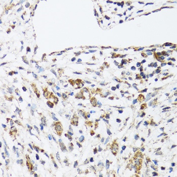 DHRS2 Antibody