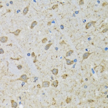 DHRS2 Antibody