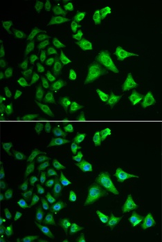 DHRS2 Antibody