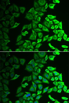 IL18BP Antibody