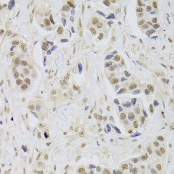 UBE3C Antibody