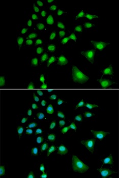 UBE3C Antibody