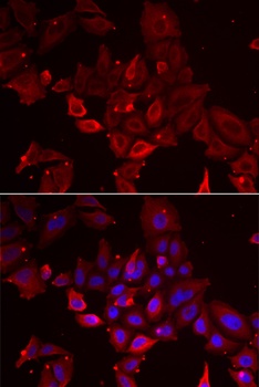 MYOT Antibody