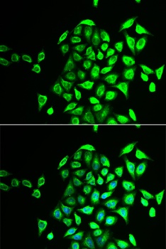 NAPG Antibody