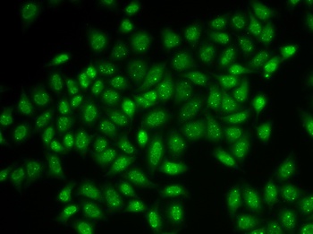 COIL Antibody