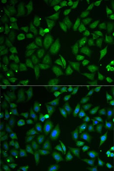 SCG2 Antibody