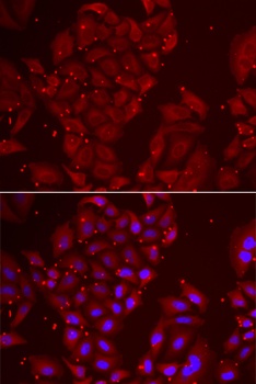 TPP2 Antibody