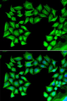 TIMP4 Antibody
