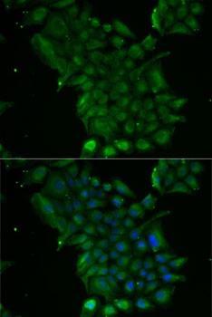 TCN1 Antibody