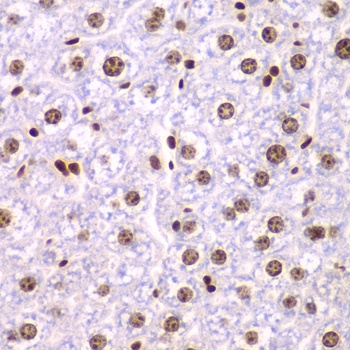 SSRP1 Antibody