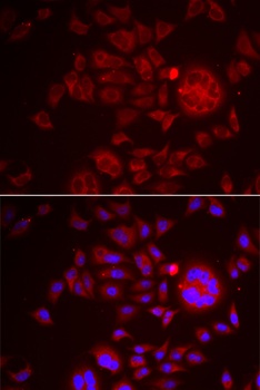 SPINT1 Antibody