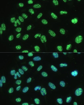 SNRPA Antibody