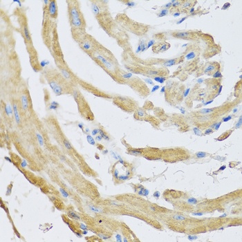 SFRP4 Antibody