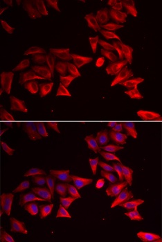 SFRP4 Antibody