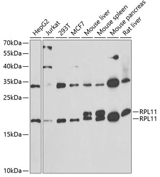 RPL11 Antibody