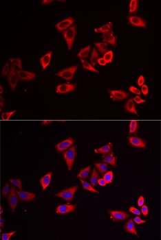 RPL9 Antibody