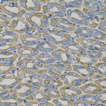 TRIM27 Antibody