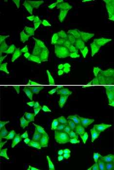 TRIM27 Antibody