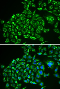 RCVRN Antibody