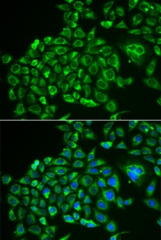 RCVRN Antibody