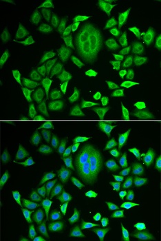 RBP3 Antibody