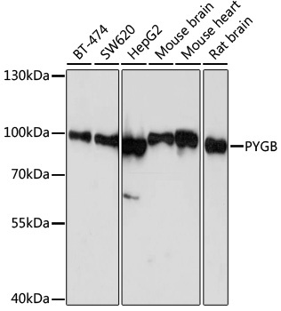 PYGB Antibody