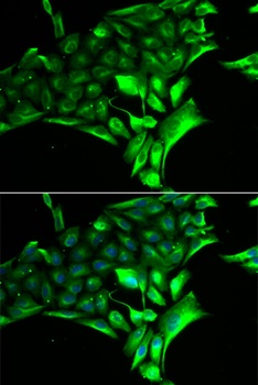 PYGB Antibody