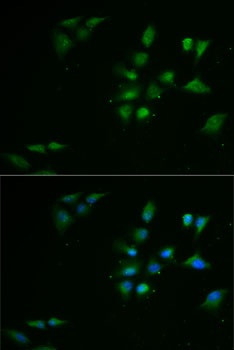 PPOX Antibody