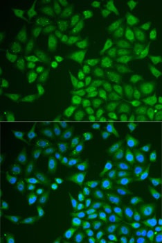 PNLIP Antibody