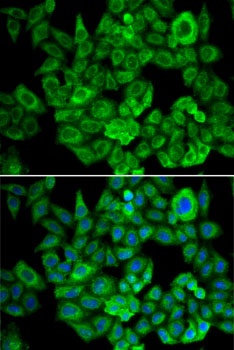 OGDH Antibody