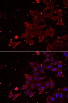 MSRA Antibody