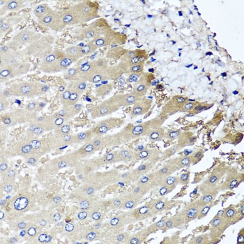 MGAT1 Antibody