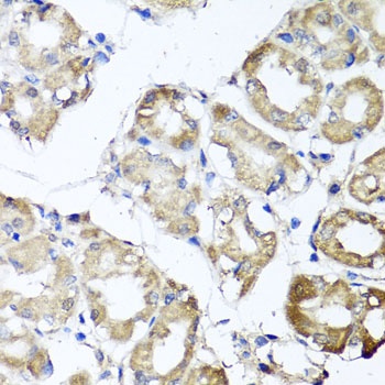 MGAT1 Antibody