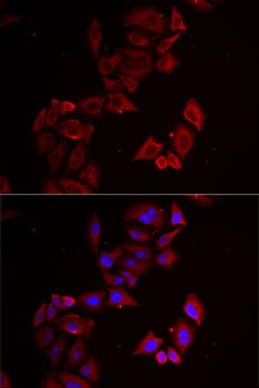 LIMS1 Antibody