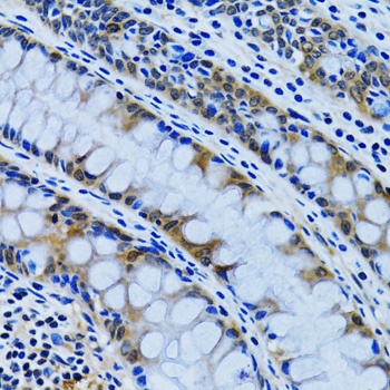 IMPA1 Antibody