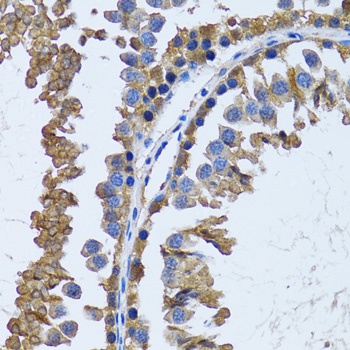 IMPA1 Antibody