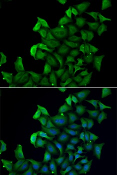FABP5 Antibody
