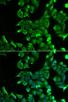 STOM Antibody