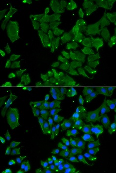 DBN1 Antibody