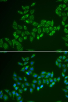 CRAT Antibody