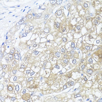 ASL Antibody