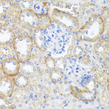 ASL Antibody