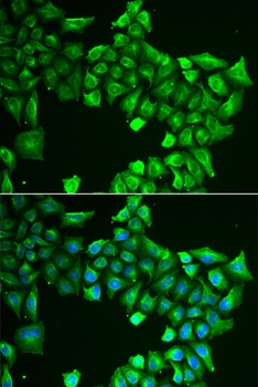 ASL Antibody