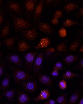 PCGF1 Antibody